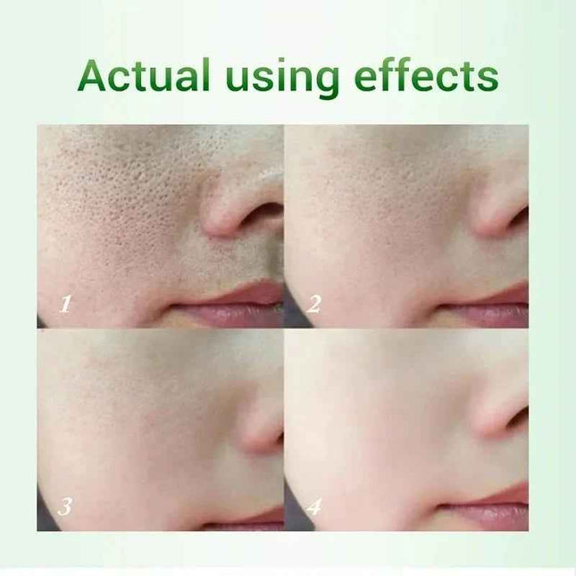 Crema Facial Acido Salicilico caja del producto