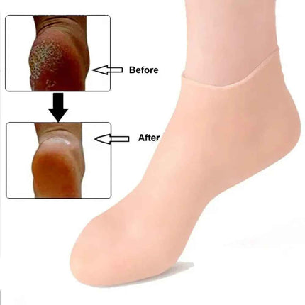 Moisturizing Silicone Gel Socks: cuidado de talones