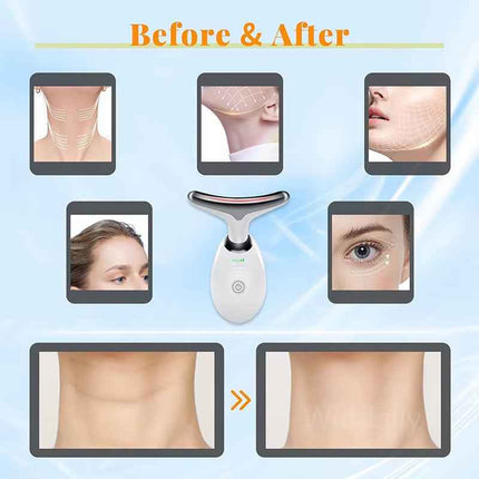Masajeador Facial y Cuello LED con Microcorrientes EMS