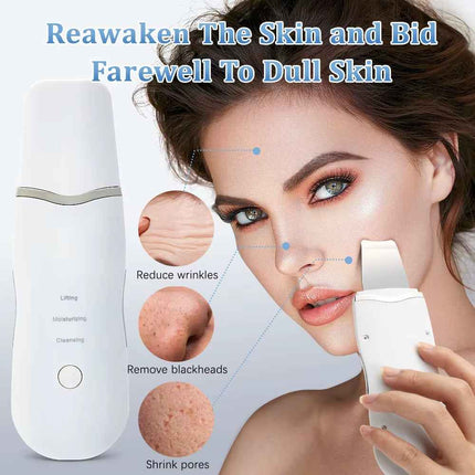 Espatula Ultrasonica Facial para Limpieza y Peeling