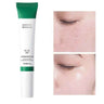 Crema Facial Acido Salicilico para Poros y Grasa