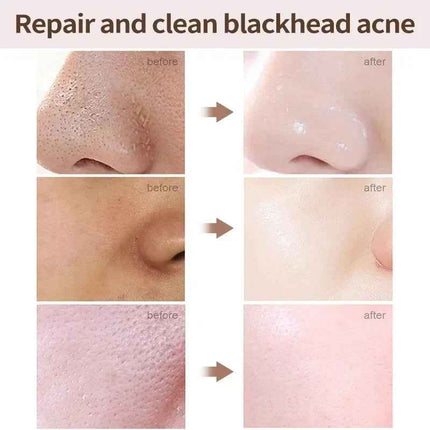 Crema Facial Acido Salicilico textura ligera de la crema