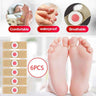 Callus & Corn Relief Patches: foot patches