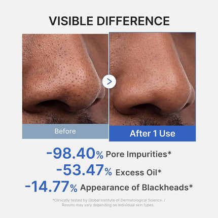 Medicube Zero Pore Blackhead Mud Mask aplicación sobre el rostro
