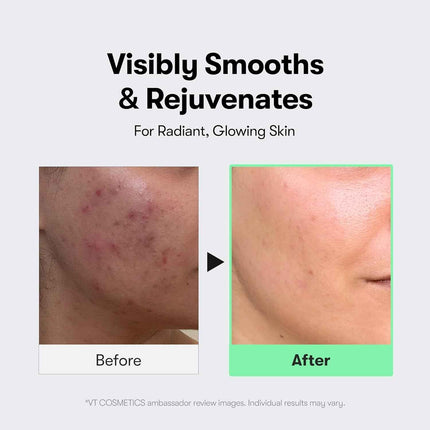 Ampolla CICA Reedle Shot 100 de VT Cosmetics