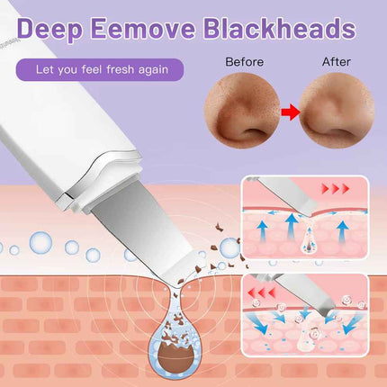 Espátula Facial Eléctrica MERALL Recargable