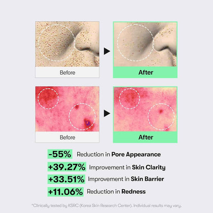 Ampolla CICA Reedle Shot 100 de VT Cosmetics